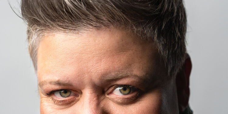 Susie McCabe Has Emergency Heart Op – but vows The Fringe Will Go On